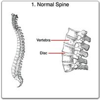 chiropractor nerang|dr peter pedersen.